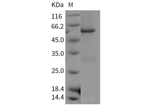Recombinant Mouse CDC2 Kinase/CDK1 Protein (His & GST Tag) - ABMIUM