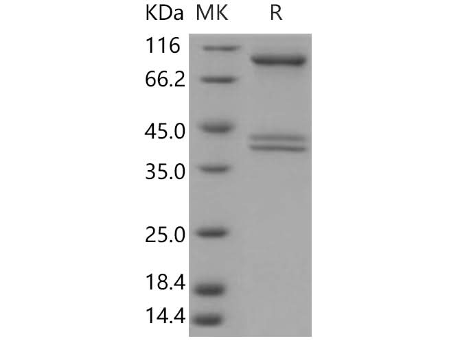 > 94 % as determined by reducing SDS-PAGE.