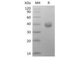 Recombinant SARS-CoV-2 Spike Protein (RBD-SD1, His Tag) - ABMIUM