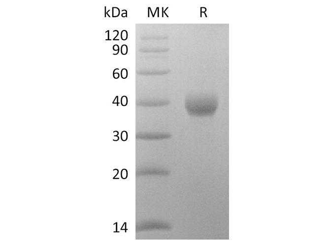 Recombinant SARS-CoV-2 Spike Protein (RBD-SD1, His Tag) - ABMIUM