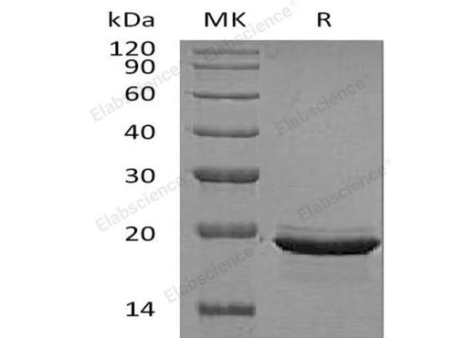 Recombinant Human FGF-12/FGF12 Protein - ABMIUM
