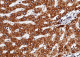 Anti-Human SerpinD1 Antibody [A947] - ABMIUM