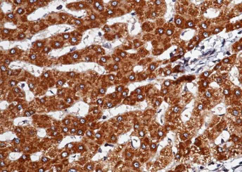 Anti-Human SerpinD1 Antibody [A947] - ABMIUM