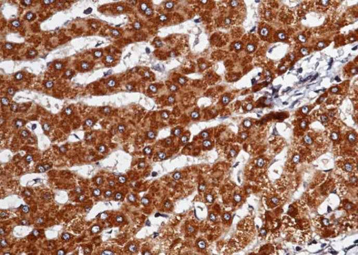 Anti-Human SerpinD1 Antibody [A947] - ABMIUM