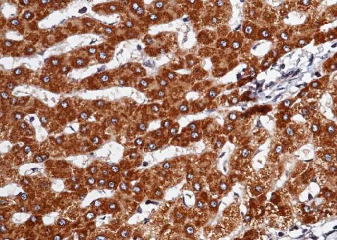 Anti-Human SerpinD1 Antibody [A947] - ABMIUM
