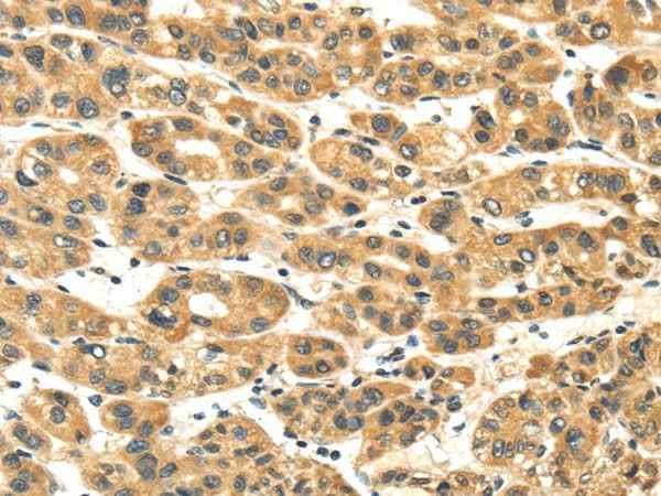 Anti-Human NME8 Antibody