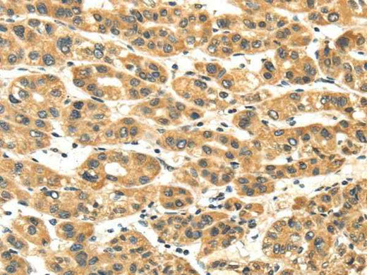 Anti-Human NME8 Antibody