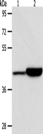 Anti-Human/Mouse/Rat CAPG Antibody - ABMIUM