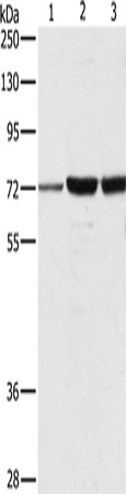 Anti-Human/Mouse/Rat DOK1 Antibody - ABMIUM
