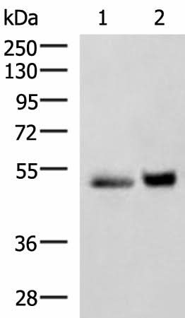 Western blot analysis of Human right lower lung tissue and Human plasma solution lysates using SIGLEC6 Polyclonal Antibody at dilution of 1:650