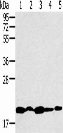 Anti-Human/Mouse/Rat RNF5 Antibody