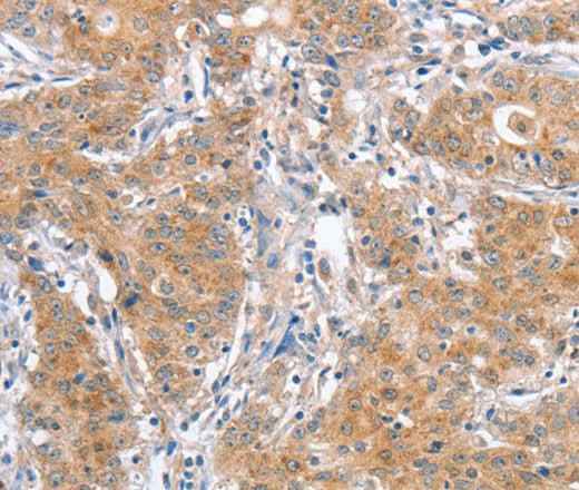 Anti-Human ATG12 Antibody