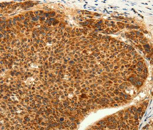Anti-Human TRPC6 Antibody - ABMIUM