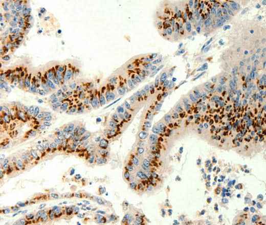 Anti-Human TRPC6 Antibody