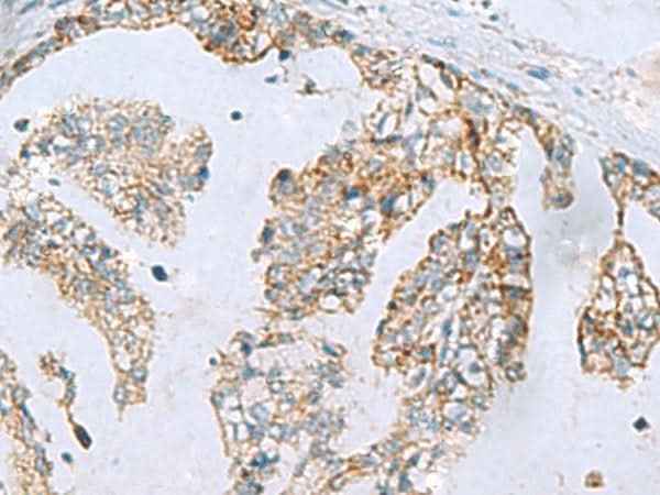 Anti-Human MGME1 Antibody
