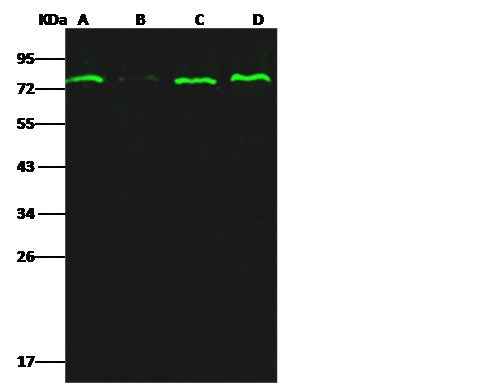 Anti-Human ESR1 Antibody [B218] - ABMIUM