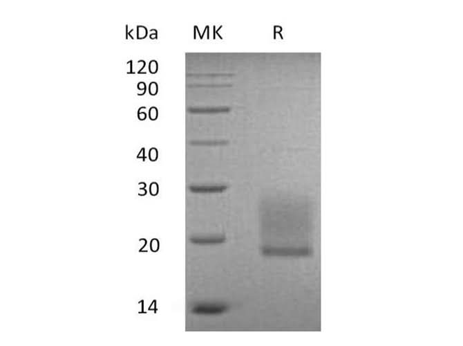 Recombinant Human BTNL9/BTN3 Protein (His Tag) - ABMIUM