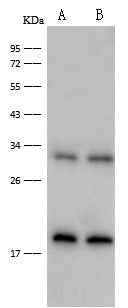 Anti-Human IFNG Antibody [A1067] - ABMIUM