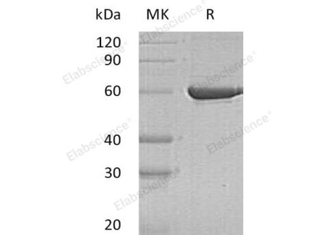 Recombinant Human PKLR Protein (His Tag) - ABMIUM