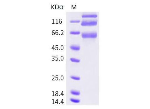 > 85 % as determined by reducing SDS-PAGE.