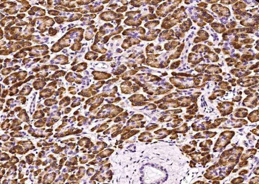 Anti-Human FGFR1 Antibody [A955] - ABMIUM