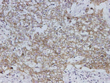 Anti-Human CK19 Antibody - ABMIUM