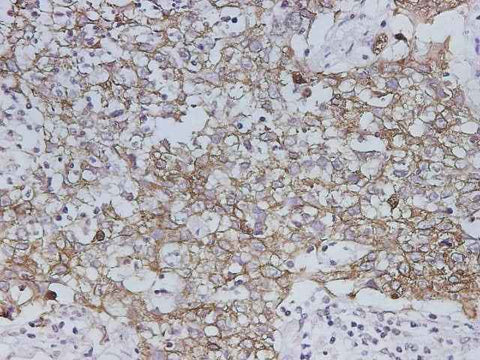 Anti-Human CK19 Antibody