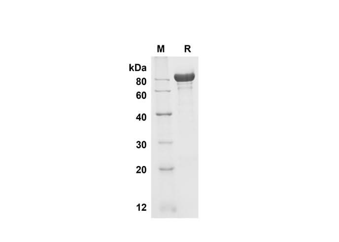 SDS-PAGE analysis of Mouse Fetuin B proteins , 2 μg/lane of Recombinant Mouse Fetuin B proteins was resolved with SDS-PAGE under reducing conditions , showing bands at 80 kDa.