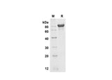 SDS-PAGE analysis of Mouse Fetuin B proteins , 2 μg/lane of Recombinant Mouse Fetuin B proteins was resolved with SDS-PAGE under reducing conditions , showing bands at 80 kDa.