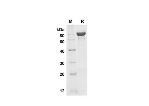 SDS-PAGE analysis of Mouse Fetuin B proteins , 2 μg/lane of Recombinant Mouse Fetuin B proteins was resolved with SDS-PAGE under reducing conditions , showing bands at 80 kDa.