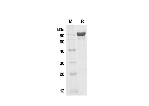 SDS-PAGE analysis of Mouse Fetuin B proteins , 2 μg/lane of Recombinant Mouse Fetuin B proteins was resolved with SDS-PAGE under reducing conditions , showing bands at 80 kDa.