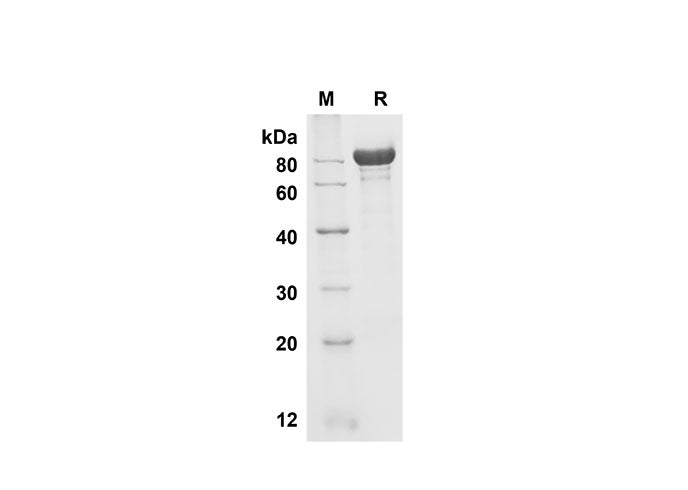 SDS-PAGE analysis of Mouse Fetuin B proteins , 2 μg/lane of Recombinant Mouse Fetuin B proteins was resolved with SDS-PAGE under reducing conditions , showing bands at 80 kDa.