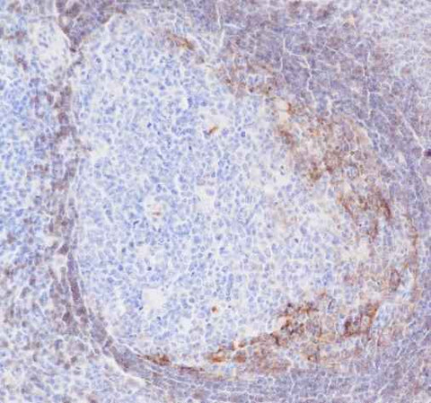 Anti-Human CD23 Antibody [A166] - ABMIUM