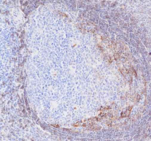 Anti-Human CD23 Antibody [A166] - ABMIUM