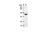 SDS-PAGE analysis of Mouse TRAIL/TNFSF10 proteins, 2 μg/lane of Recombinant Mouse TRAIL/TNFSF10 proteins was resolved with an SDS-PAGE under reducing conditions, showing bands at 39 kDa.