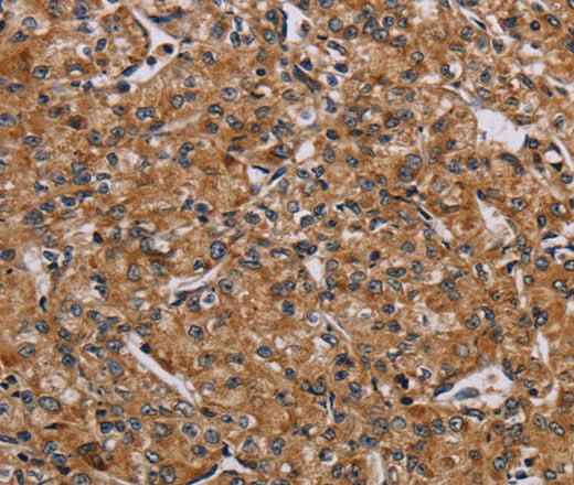Anti-Human/Mouse AATK Antibody