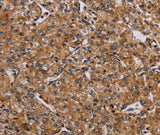 Anti-Human/Mouse AATK Antibody - ABMIUM