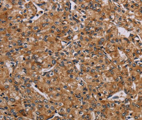 Anti-Human/Mouse AATK Antibody - ABMIUM
