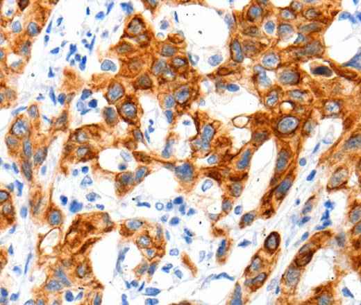 Anti-Human SLC2A11 Antibody