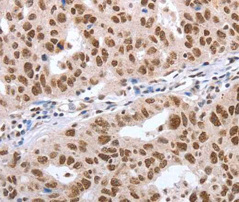 Anti-Human/Mouse/Rat POU3F1 Antibody