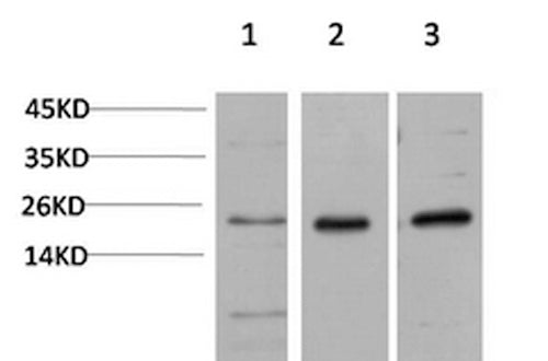 Western Blot analysis of 1) Hela, 2)3T3, 3) PC-12 cells using CBX5 Monoclonal Antibody at dilution of 1:1000.
