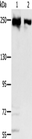 Anti-Human MCM3AP Antibody - ABMIUM