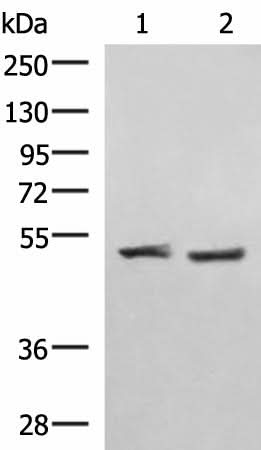 Western blot analysis of Human cerebella tissue K562 cell lysates using RRP8 Polyclonal Antibody at dilution of 1:1000