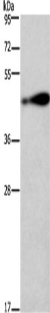 Anti-Human AGER Antibody - ABMIUM