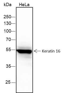 Anti-Human Keratin 16 Antibody [A274]