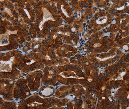 Anti-Human/Mouse KLHL1 Antibody
