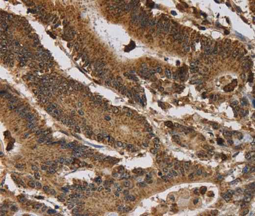 Anti-Human ITPR3 Antibody