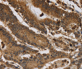 Anti-Human ITPR3 Antibody - ABMIUM