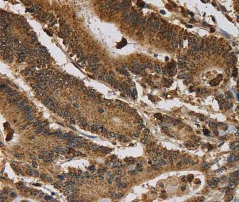 Anti-Human ITPR3 Antibody
