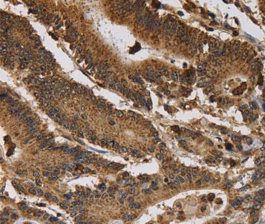 Anti-Human ITPR3 Antibody - ABMIUM